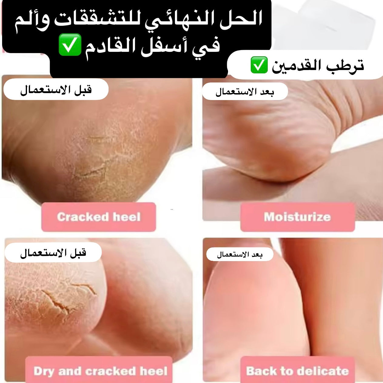 ✅ الحل نهائي للتشققات ❌ مع 4 قطع وداعا ألم القدمي